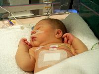 December 18, 2002 - 7 days old