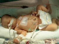 December 16, 2002 - My first days in the hospital