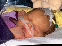 December 21, 2002 - 10 days old