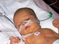 January 15, 2003 - 35 days old