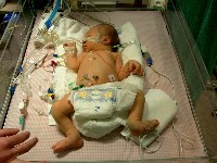 December 16, 2002 - 5 days old - First days in hospital
