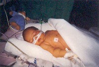 January 22, 2003 - 42 days old