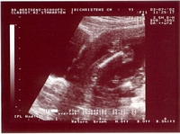 Ultrasound - July 3, 2002
