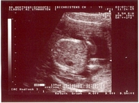 Ultrasound - July 3, 2002