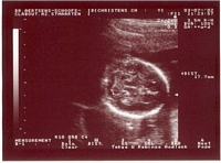 Ultrasound - July 3, 2002