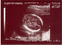 Ultrasound - July 3, 2002