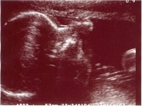 Ultrasound - August 5, 2002